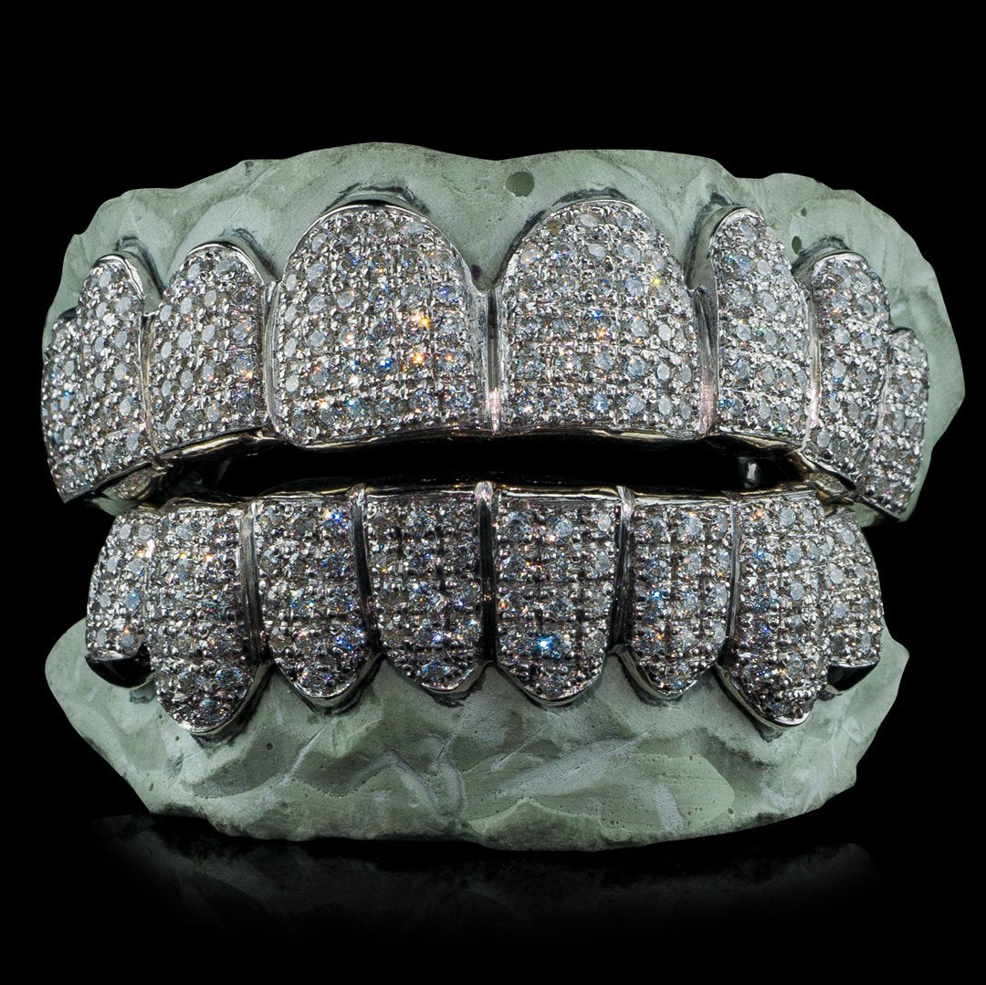Combien coute un grillz ?